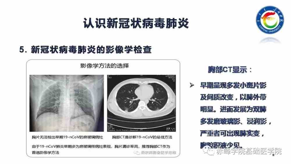 最新型怪状肺炎